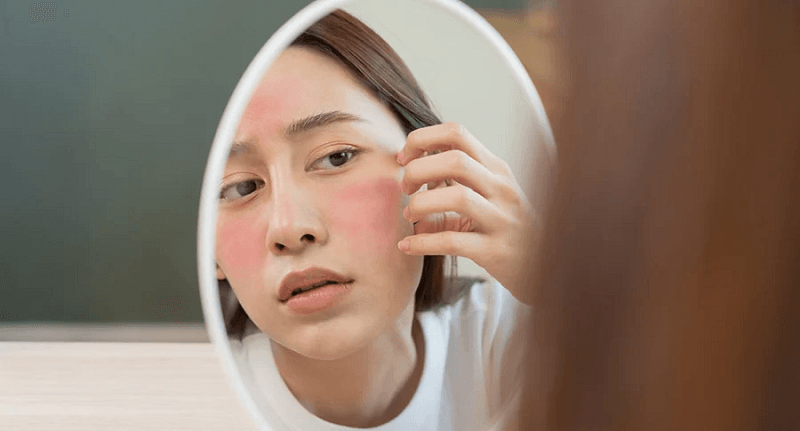 Đối với da nhạy cảm