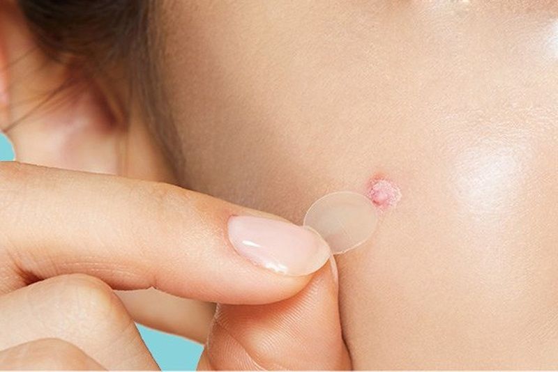 Giảm tấy đỏ và sưng viêm