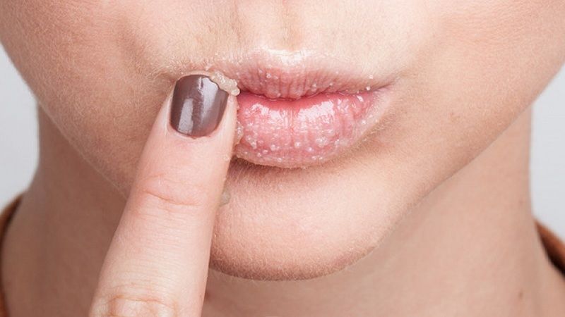 Bước 1: Loại bỏ vảy môi khô (Tẩy tế bào chết an toàn)