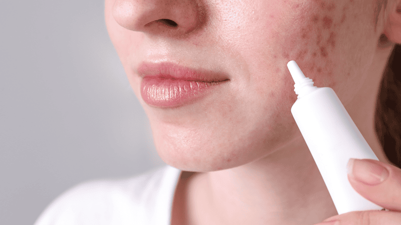 Dùng tần suất thưa thớt