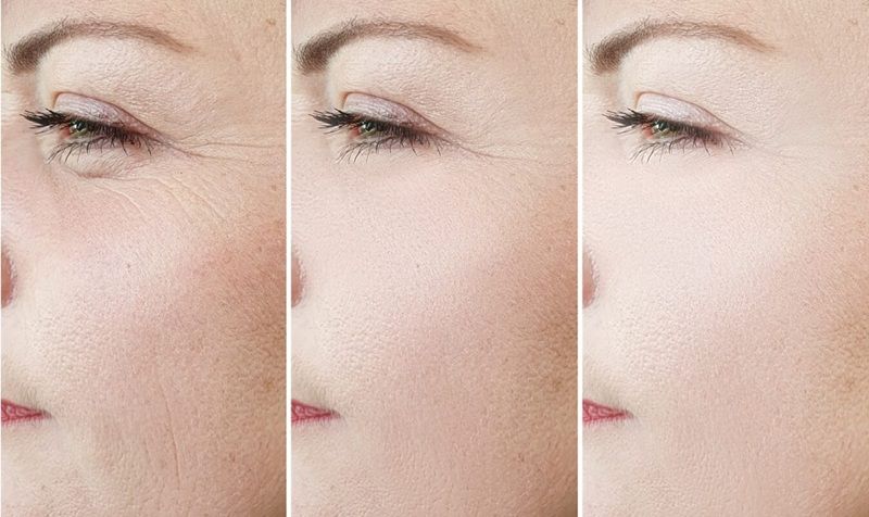 Giải thích khái niệm