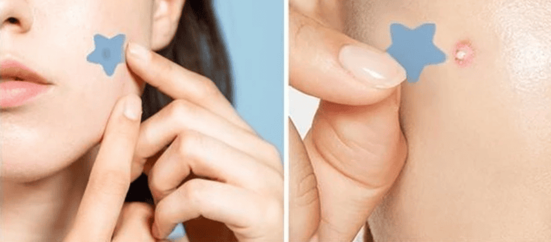 Cơ chế hoạt động