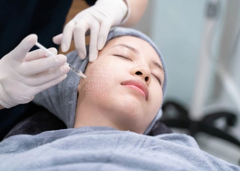 Các tác dụng phụ tiềm ẩn (thường nhẹ)