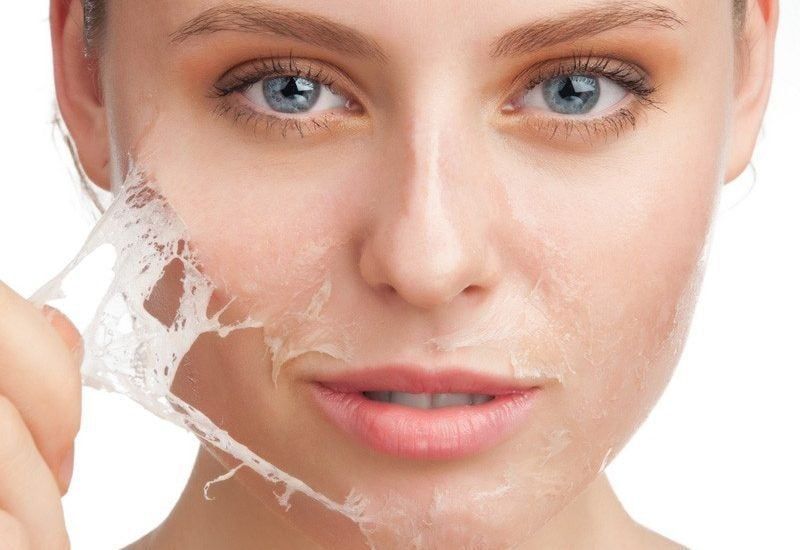 Lột da mặt, dù là lột hóa học hay lột vật lý ở cấp độ nhẹ, đều tác động lên lớp thượng bì của da, loại bỏ các tế bào chết, hư tổn hoặc kích thích quá trình bong tróc tự nhiên.
