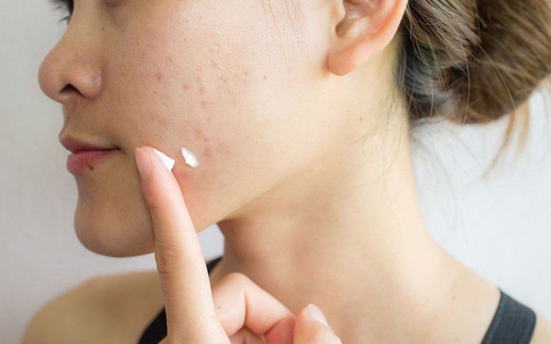 Bước 5: Kiên trì theo dõi