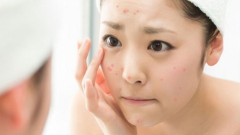 Da dầu/Da mụn: Khuyến nghị 2 lần/ngày (sáng + tối)