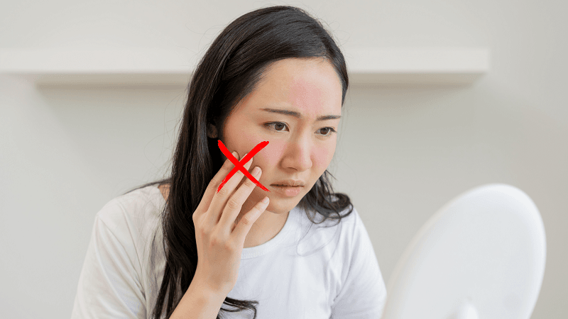 KHÔNG chạm tay, sờ nắn, cạy gỡ da