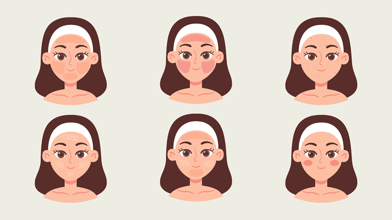 Lựa chọn theo từng loại da