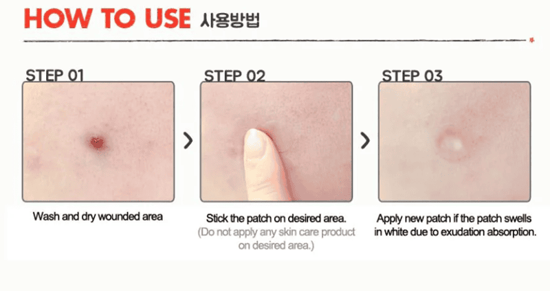 Các bước thực hiện