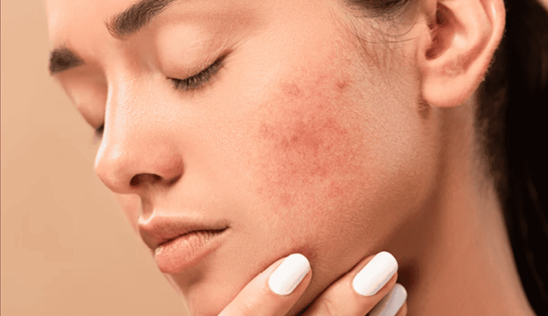 Tác nhân bên ngoài