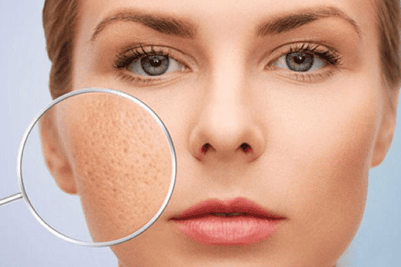 Cân bằng dầu nhờn và se khít lỗ chân lông