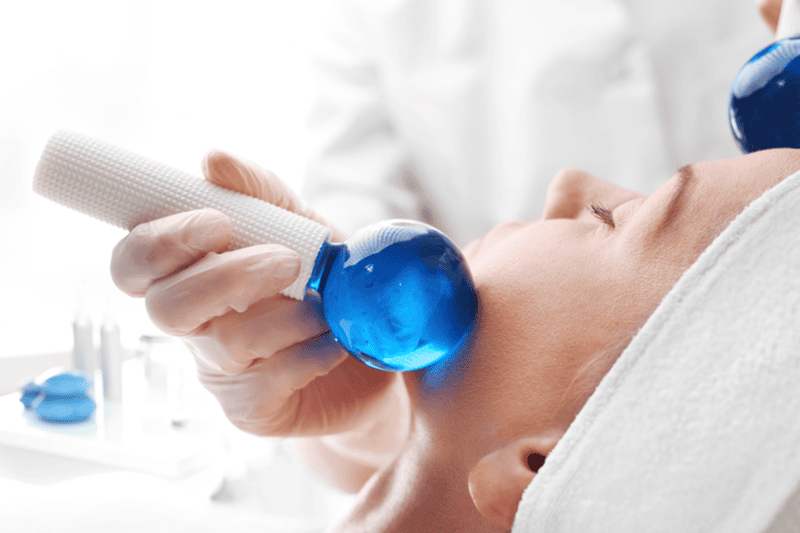 Hiệu ứng từ nhiệt độ lạnh (Skin Icing)