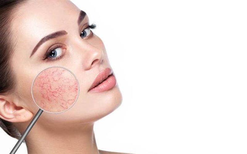 Làn da nhạy cảm không chỉ cần những sản phẩm phù hợp, mà còn cần cả sự nhẹ nhàng trong thói quen chăm sóc và sinh hoạt hằng ngày