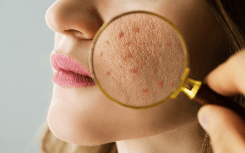 Mỗi loại da sẽ có nhu cầu dưỡng trắng và cấp ẩm khác nhau