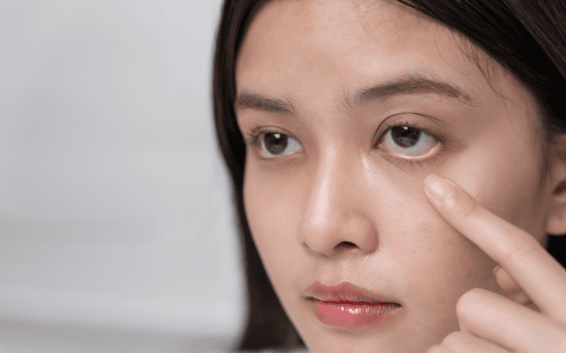 Tình trạng kem chống nắng bị cay mắt không chỉ gây khó chịu tức thì mà còn có thể để lại những ảnh hưởng lâu dài nếu không khắc phục đúng cách