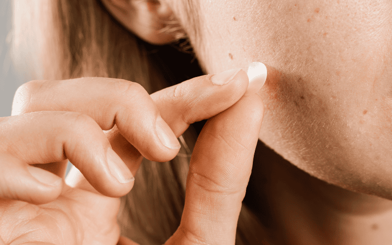 Sử dụng đúng cách giúp miếng dán mụn phát huy tối đa hiệu quả, hỗ trợ hút dịch mụn, giảm sưng viêm và hạn chế vi khuẩn xâm nhập gây tổn thương da