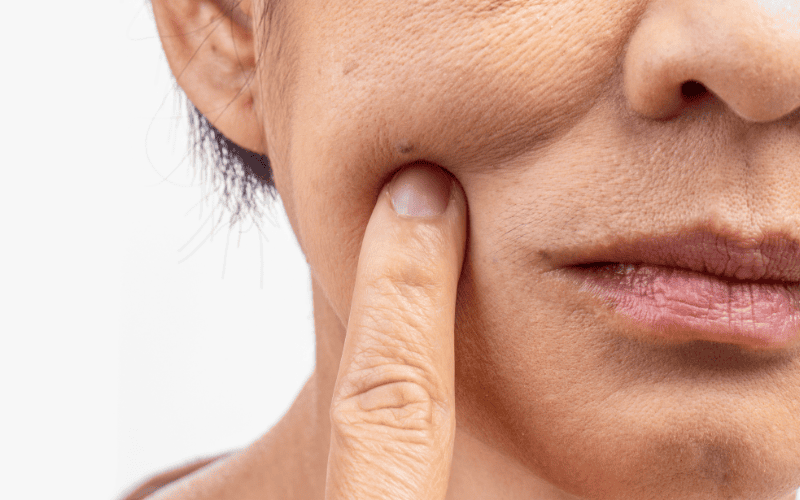 Việc bỏ qua kem chống nắng khiến tia UVA dễ dàng xuyên sâu vào da, phá hủy collagen và elastin