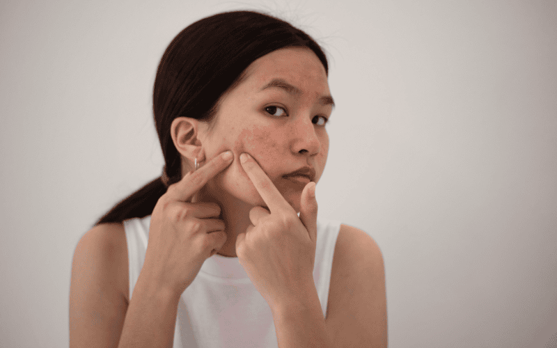 Câu trả lời sẽ phụ thuộc vào tình trạng làn da ngay sau khi nặn mụn và loại nước tẩy trang mà bạn lựa chọn