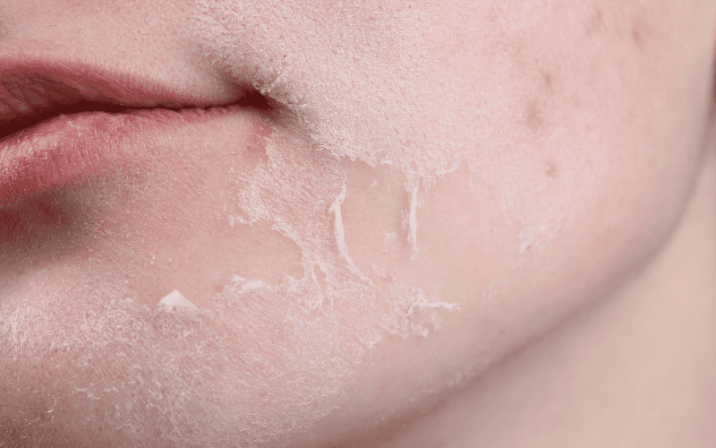 Mỗi loại da có đặc điểm và nhu cầu riêng, vì vậy kem dưỡng phục hồi cũng cần được chọn lựa kỹ lưỡng