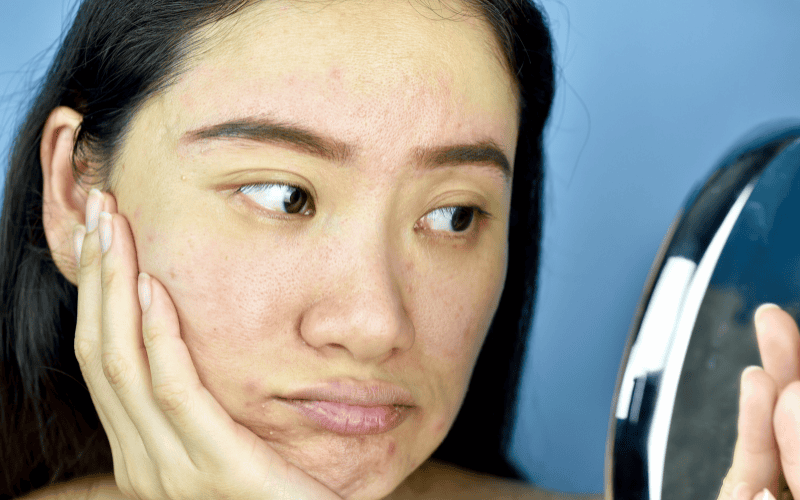 Sản phẩm phù hợp với nhiều loại da khác nhau