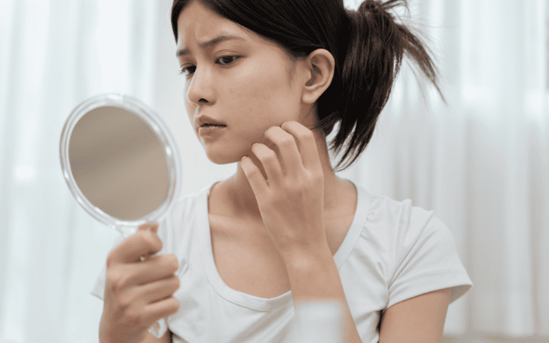 Thời gian phục hồi của da sau khi bị dị ứng mặt nạ sữa chua phụ thuộc vào mức độ tổn thương và cách bạn chăm sóc trong giai đoạn này