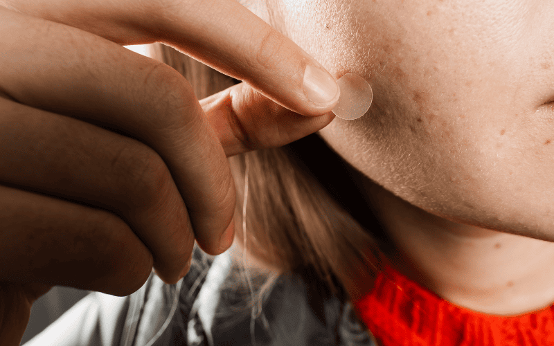 Miếng dán giúp bảo vệ vết thương hở, ngăn vi khuẩn xâm nhập và giảm sưng tấy