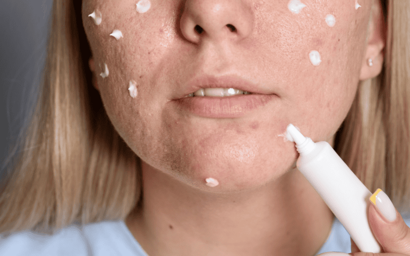 Mẹ cần tránh một số loại mỹ phẩm có khả năng thấm sâu hoặc chứa hoạt chất mạnh