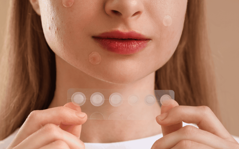 Biết rõ nên dùng miếng dán mụn khi nào sẽ giúp bạn tận dụng tối đa hiệu quả mà sản phẩm mang lại, đồng thời tránh gây bí da hoặc lãng phí