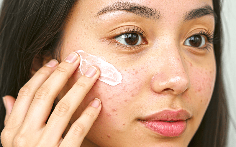 Lựa chọn sữa rửa mặt không đúng loại da có thể khiến tình trạng da trở nên tệ hơn
