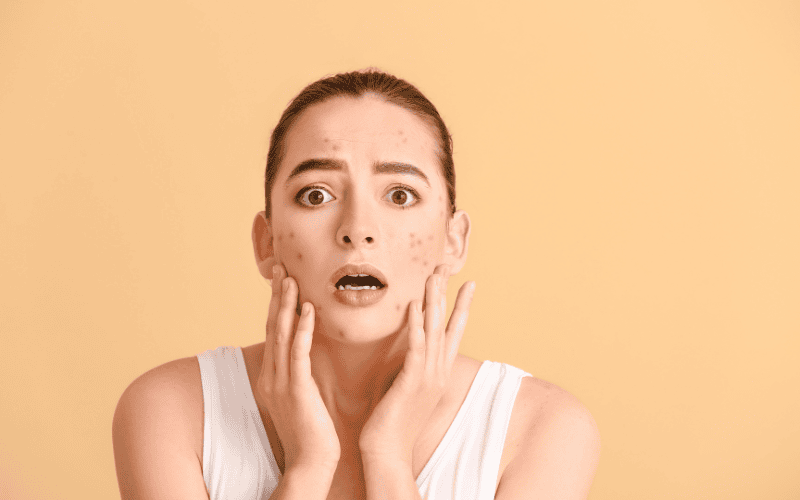 Việc chăm sóc da dầu mụn luôn khiến nhiều người băn khoăn vì không biết nên chọn sản phẩm nào, kết hợp ra sao để đạt hiệu quả tốt nhất