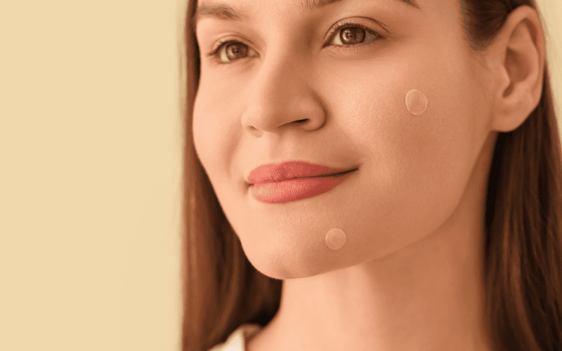 Khi khả năng bám giảm, miếng dán không còn bảo vệ vết mụn tốt như ban đầu và dễ bị vi khuẩn xâm nhập