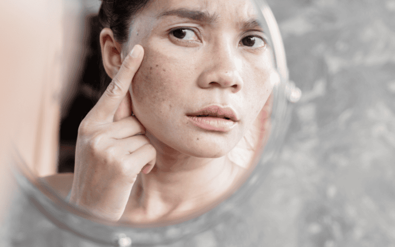 Khi dùng mỹ phẩm trị nám cần kết hợp sản phẩm đúng cách và duy trì thói quen chăm sóc da khoa học