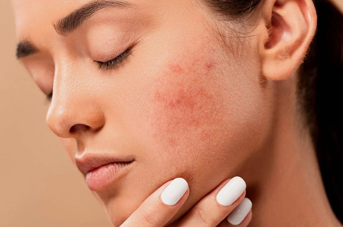 Sản phẩm cần phù hợp với tình trạng da cụ thể