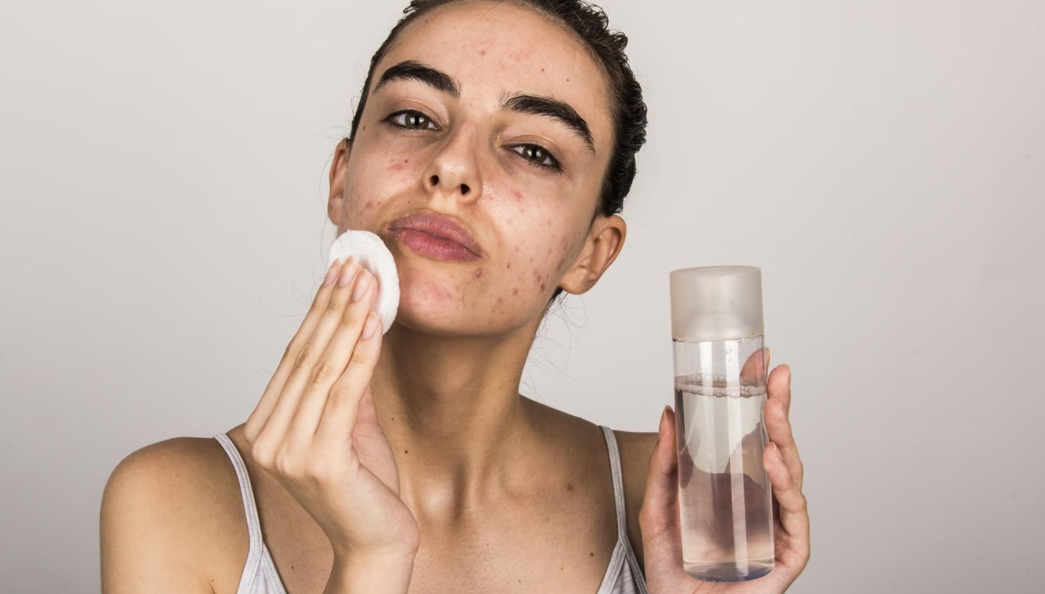 Các bước skincare cho da dầu mụn viêm
