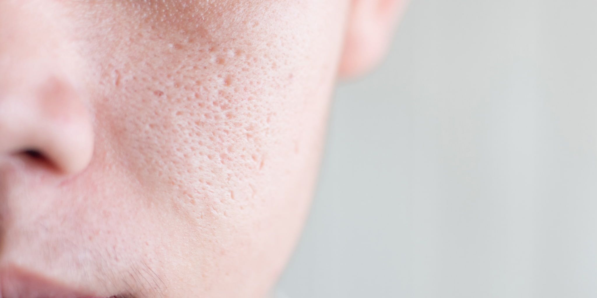 Nhận biết loại da qua kích thước lỗ chân lông