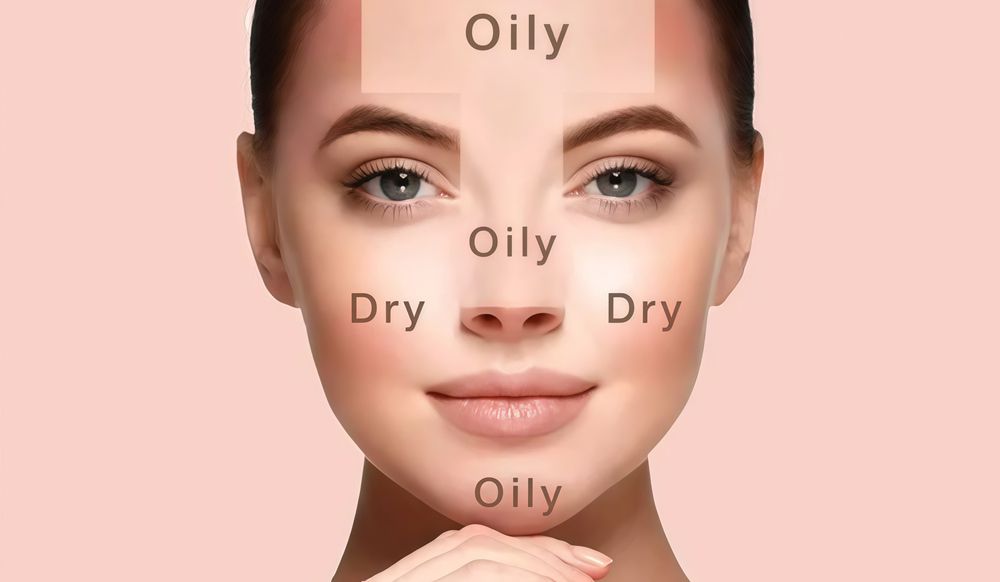 Da hỗn hợp tích hợp đặc điểm của nhiều loại da