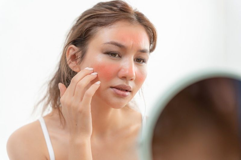 Da nhạy cảm thường phản ứng mạnh với các yếu tố từ môi trường