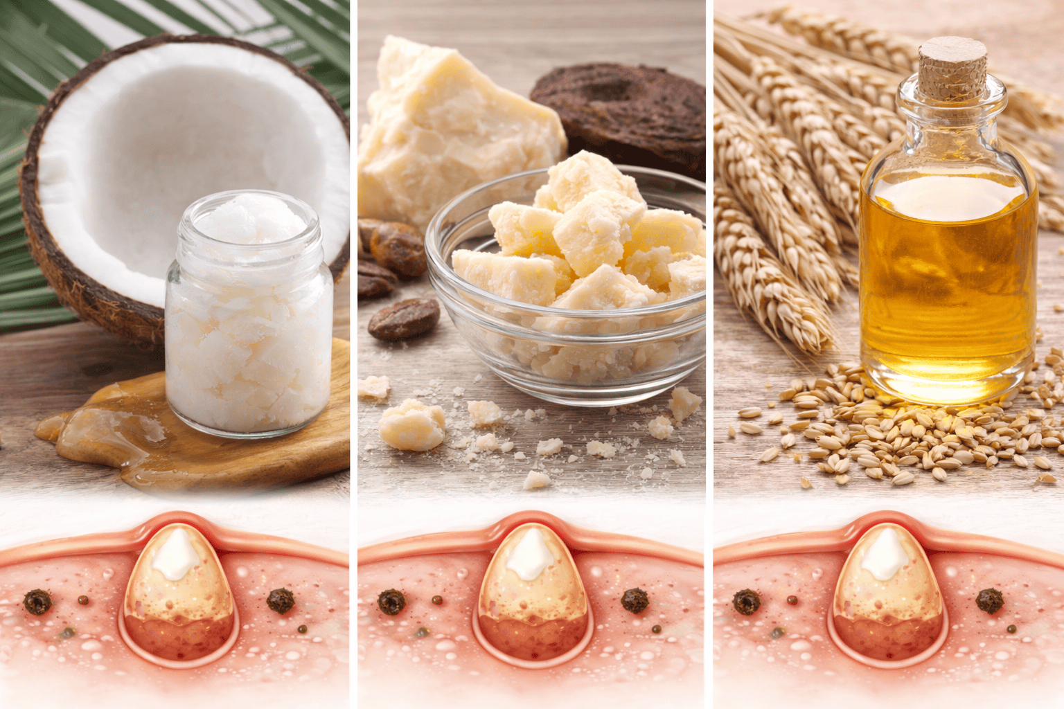 các thành phần trong mỹ phẩm gây mụn ẩn hình 1.png