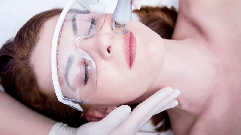 Laser sử dụng năng lượng ánh sáng tập trung để tác động vào các lớp da sâu bên dưới