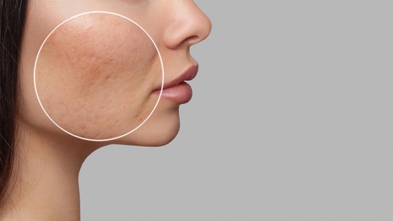 Bạn cần che chắn da kỹ càng để tránh tác hại từ ánh nắng mặt trời