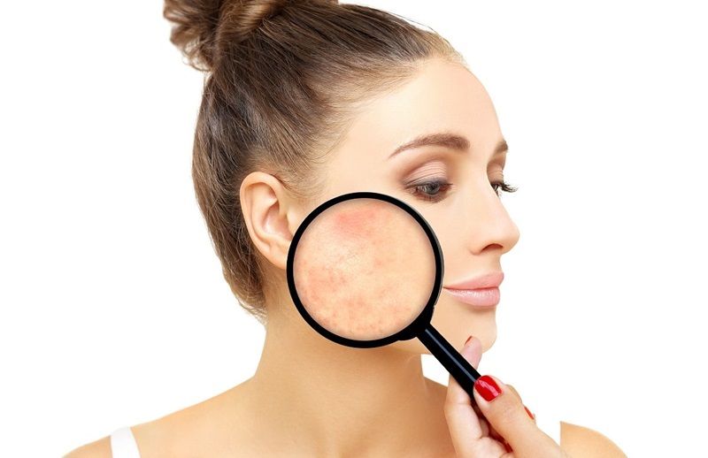 Bạn có thể sử dụng các giải pháp công nghệ cao tiên tiến nếu có vết sẹo khó trị