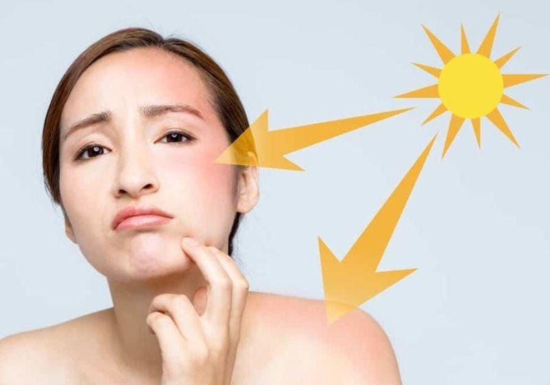 Giảm hiệu quả chống nắng