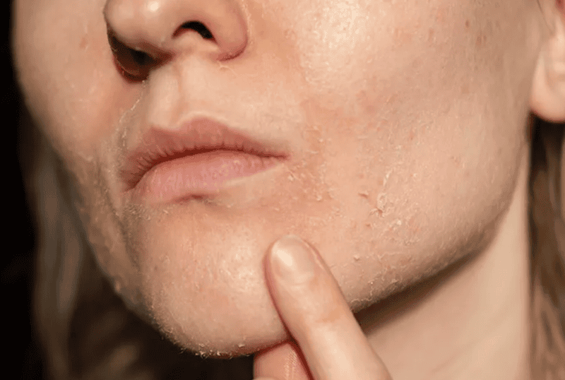 Khi thời tiết chuyển lạnh, da thường có những phản ứng rõ rệt do ảnh hưởng của môi trường khô hanh cùng nhiệt độ thấp