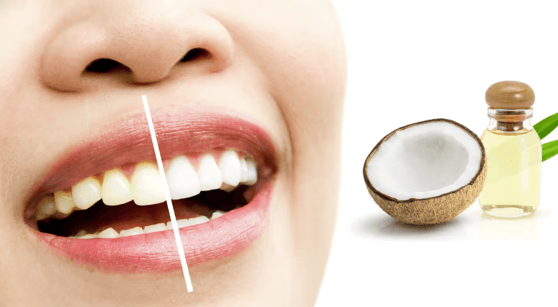 Dầu dừa giúp loại bỏ vi khuẩn gây hôi miệng, cải thiện sức khỏe nướu và làm trắng răng nhẹ nhàng