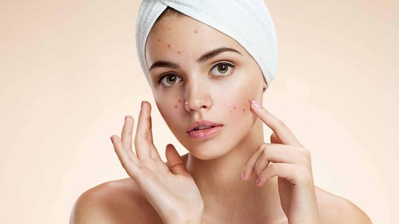 Tình trạng da tiết nhiều dầu thực chất có thể là dấu hiệu của việc thiếu ẩm