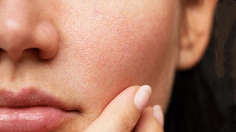 Da nhạy cảm là gì? Dấu hiệu nhận biết