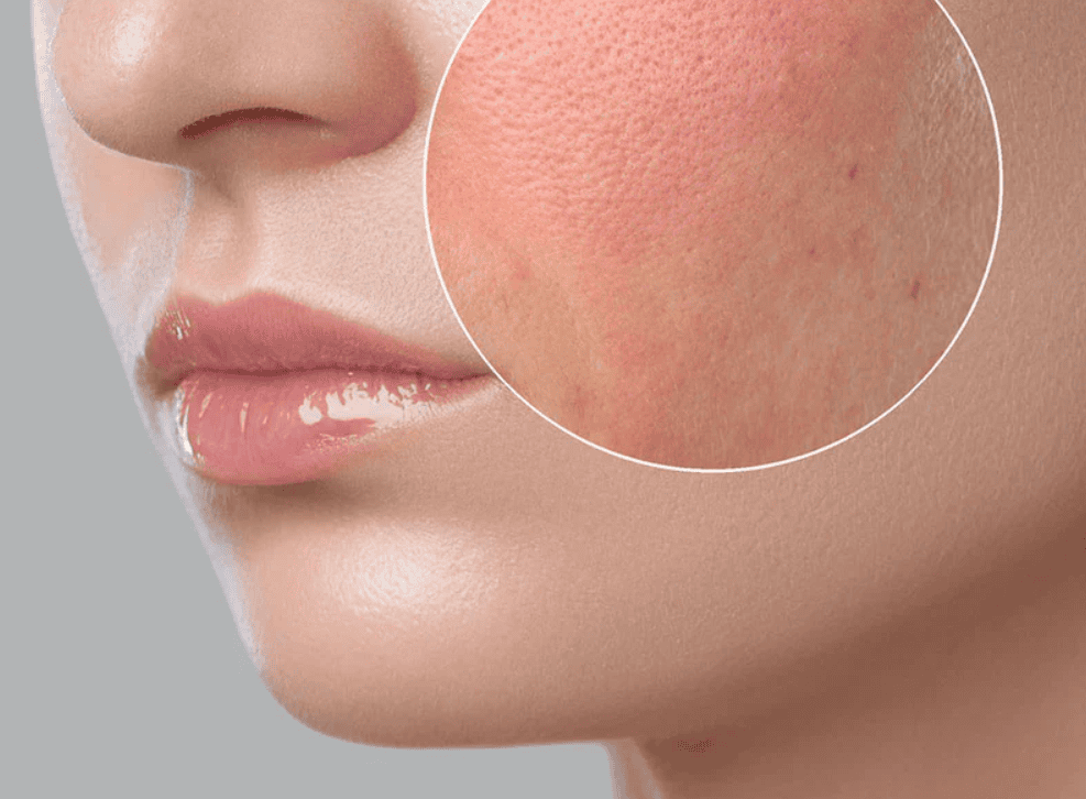 đắp mặt nạ trước hay sau dưỡng ẩm hình 4.png