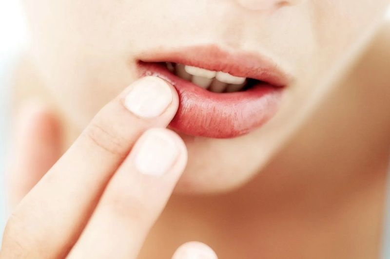 Bạn nên rửa lại môi vào sáng hôm sau sau khi dưỡng bằng mật ong qua đêm