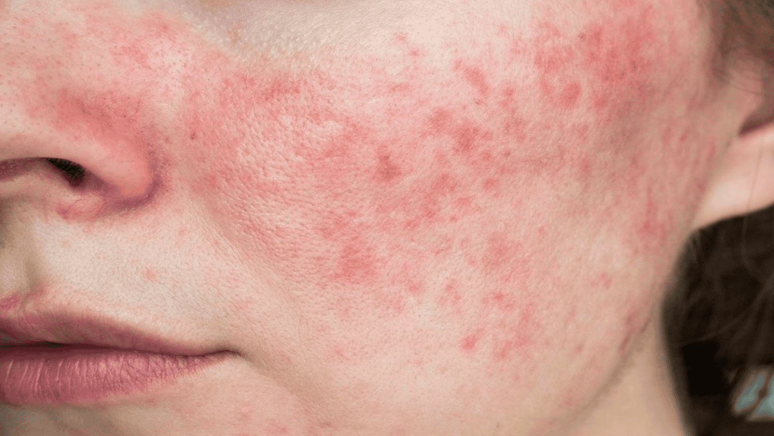 hạn sử dụng của mặt nạ hàn quốc hình 3.png