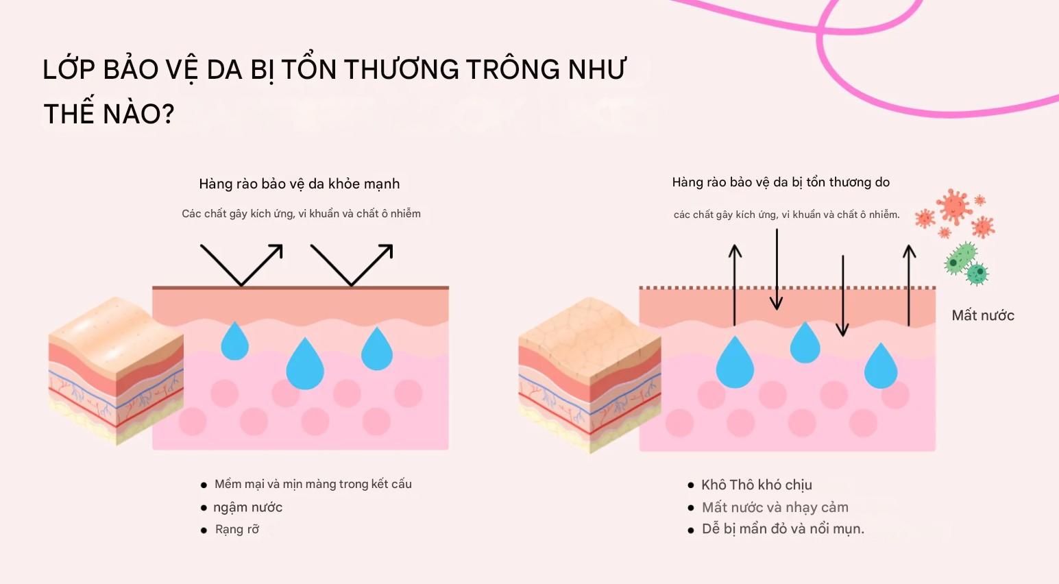 Hàng rào bảo vệ da yếu không thể thực hiện tốt chức năng của mình